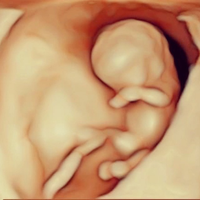 まだ、胎動を感じることはできない妊娠１０週の胎児の超音波画像です。 もうこの時期から手足がしっかりでき、パタパタ動いてくれています。